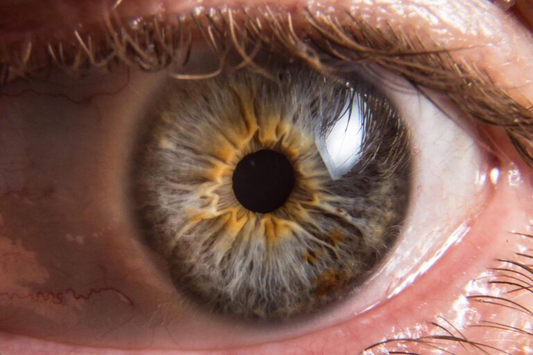 Eye-Macro-Close-Up