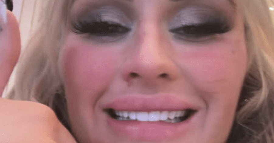 Tiff_teeth