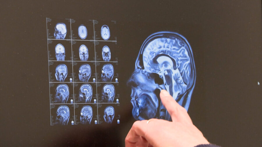 brain_health_042425-e1745535080415