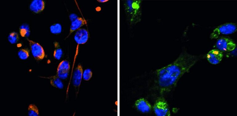 how-breast-cancer-cell