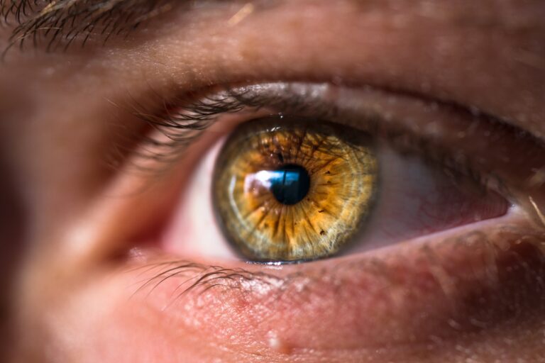 eye-bulging