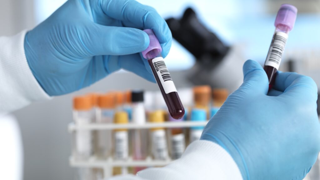 Hand holding blood sample in laboratory